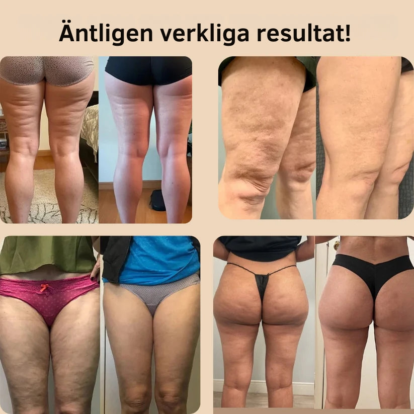 CelluFri Muotoilevat Shortsit