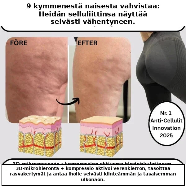 3D-muotoilevat selluliittia ehkäisevät leggingsit