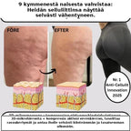 3D-muotoilevat selluliittia ehkäisevät leggingsit
