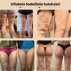 3D-muotoilevat selluliittia ehkäisevät leggingsit